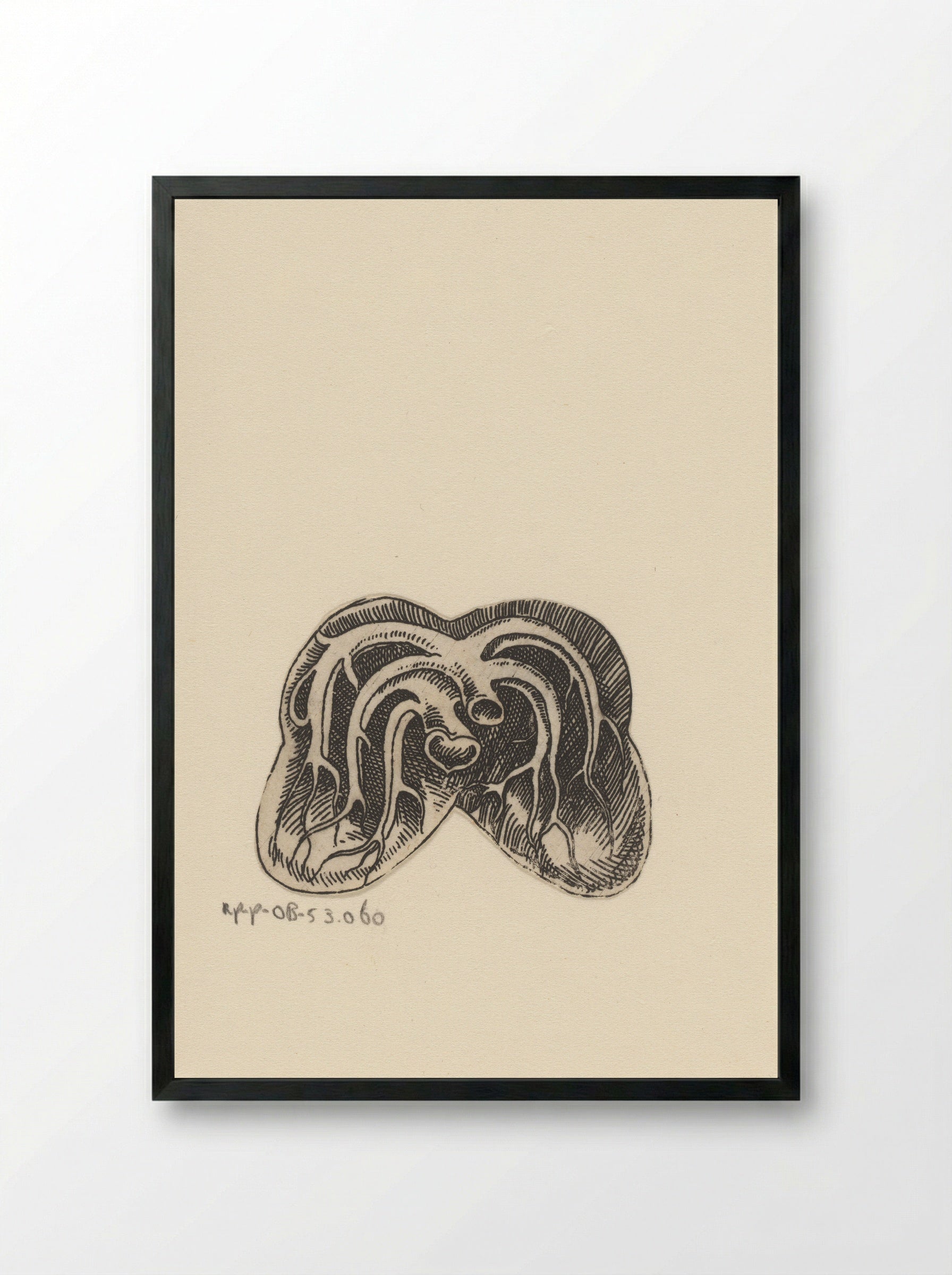 Dwarsdoorsnede longen - Lucas Kilian - Framed Print Black