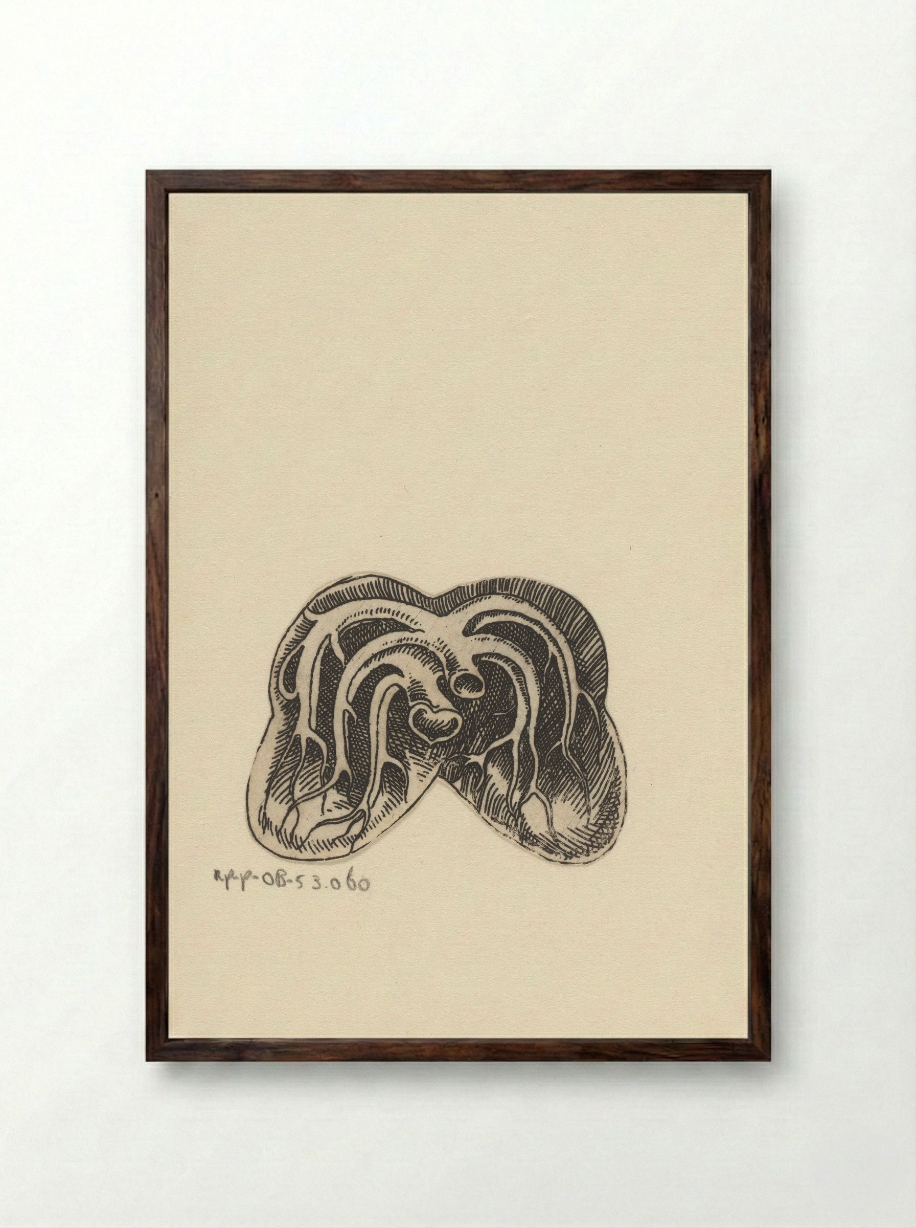 Dwarsdoorsnede longen - Lucas Kilian - Framed Print Dark Wood