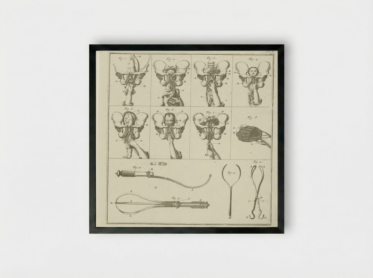 Gynaecologische voorstellingen (Plate 4) - Nicolaas van Frankendaal - Framed Print Black