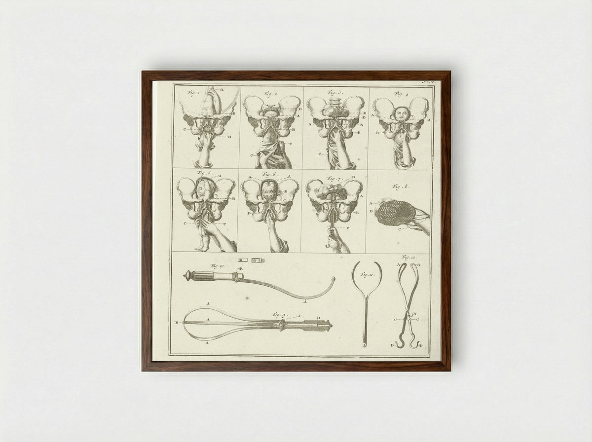 Gynaecologische voorstellingen (Plate 4) - Nicolaas van Frankendaal - Framed Print Dark Wood