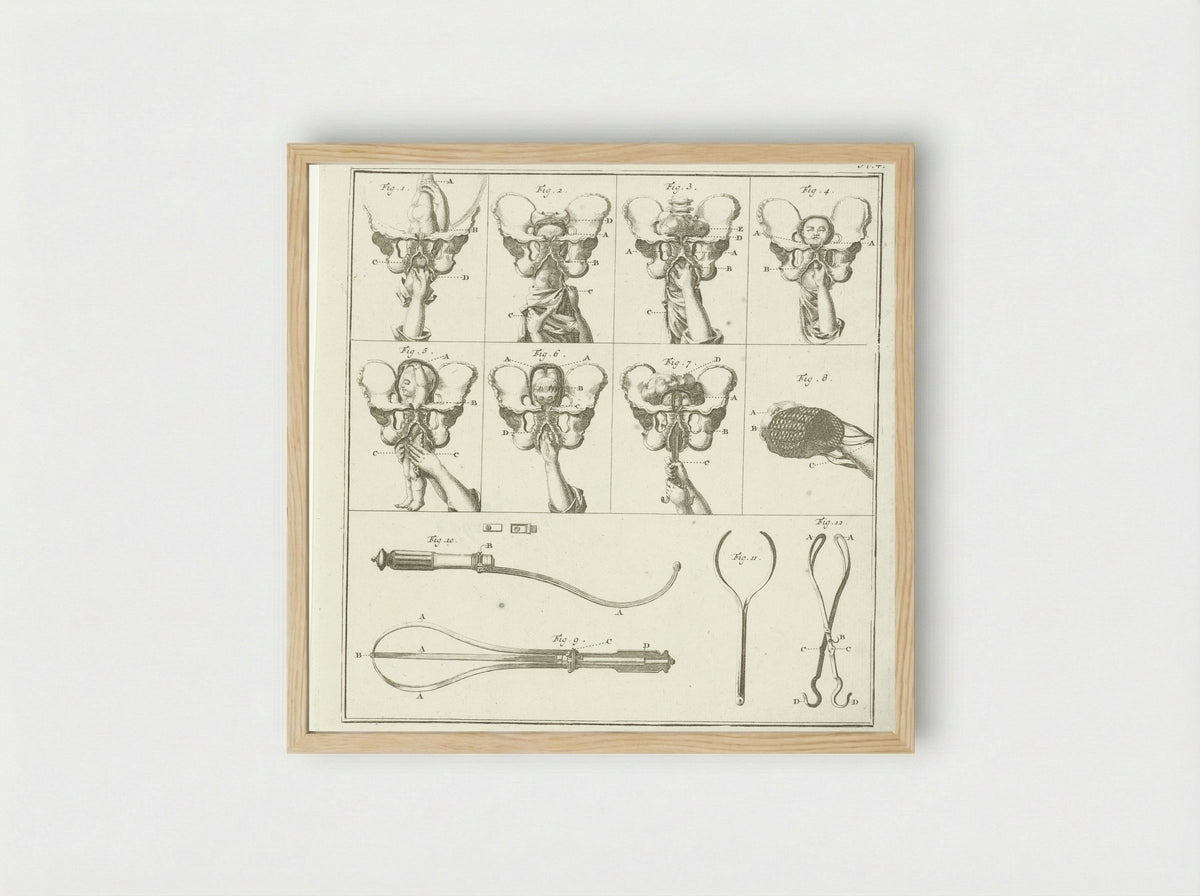 Gynaecologische voorstellingen (Plate 4) - Nicolaas van Frankendaal - Framed Print Wood