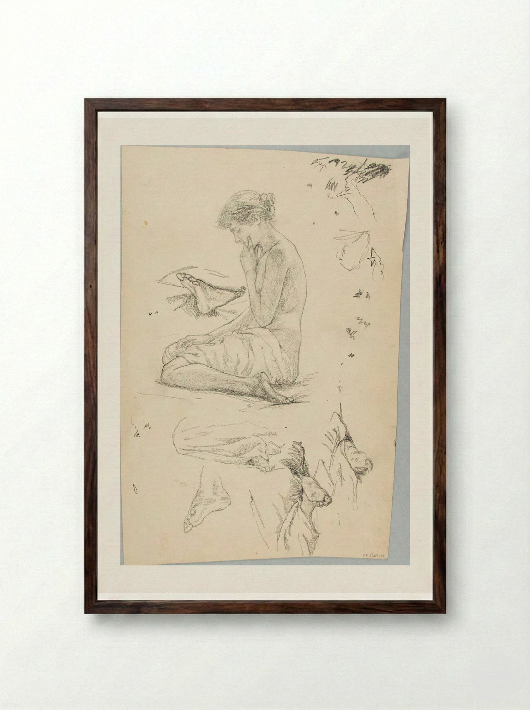 Sketches of the Human Body - William Valentine Schevill - Framed Print Dark Wood