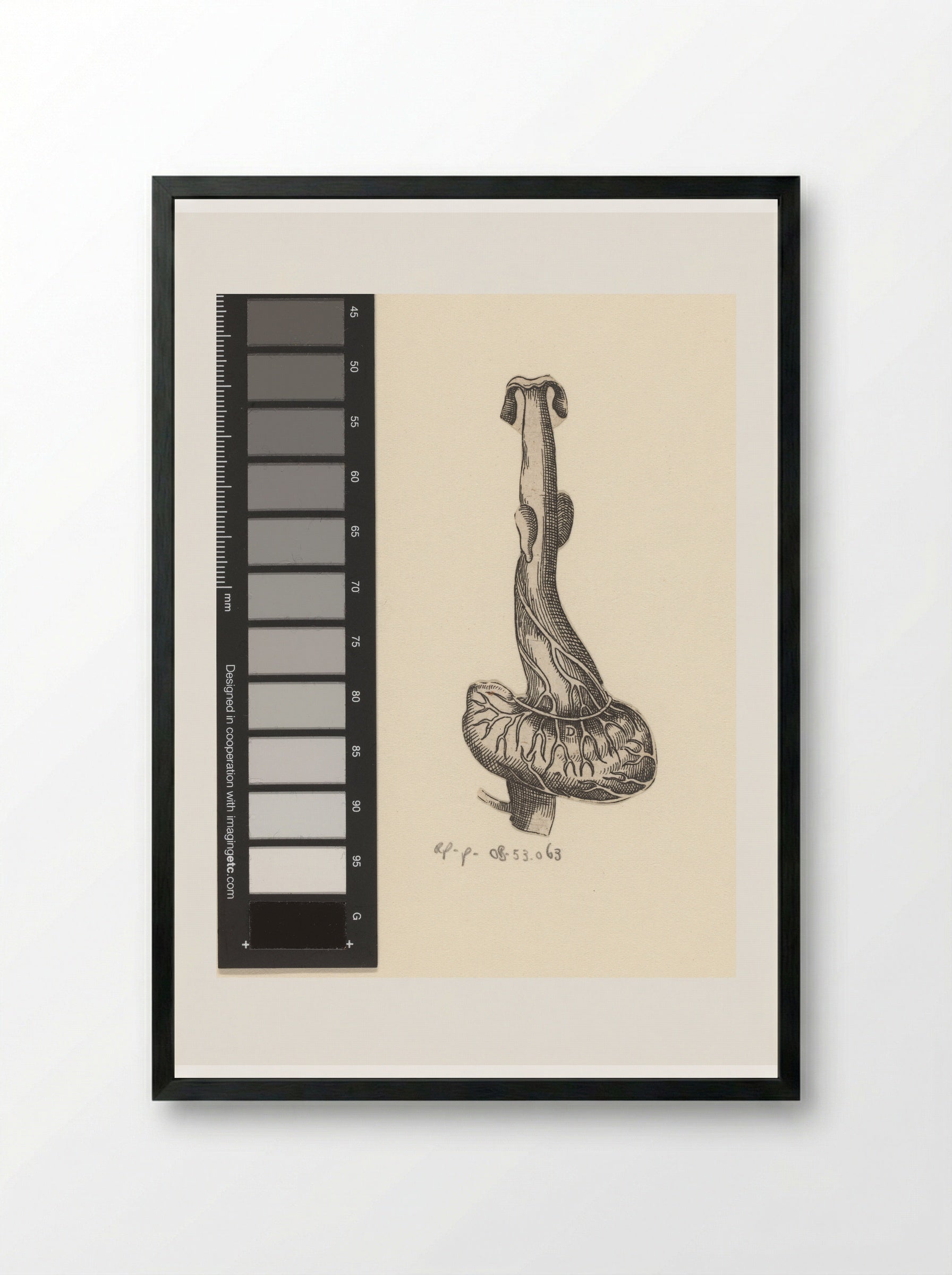Slokdarm en maag - Lucas Kilian - Framed Print Black