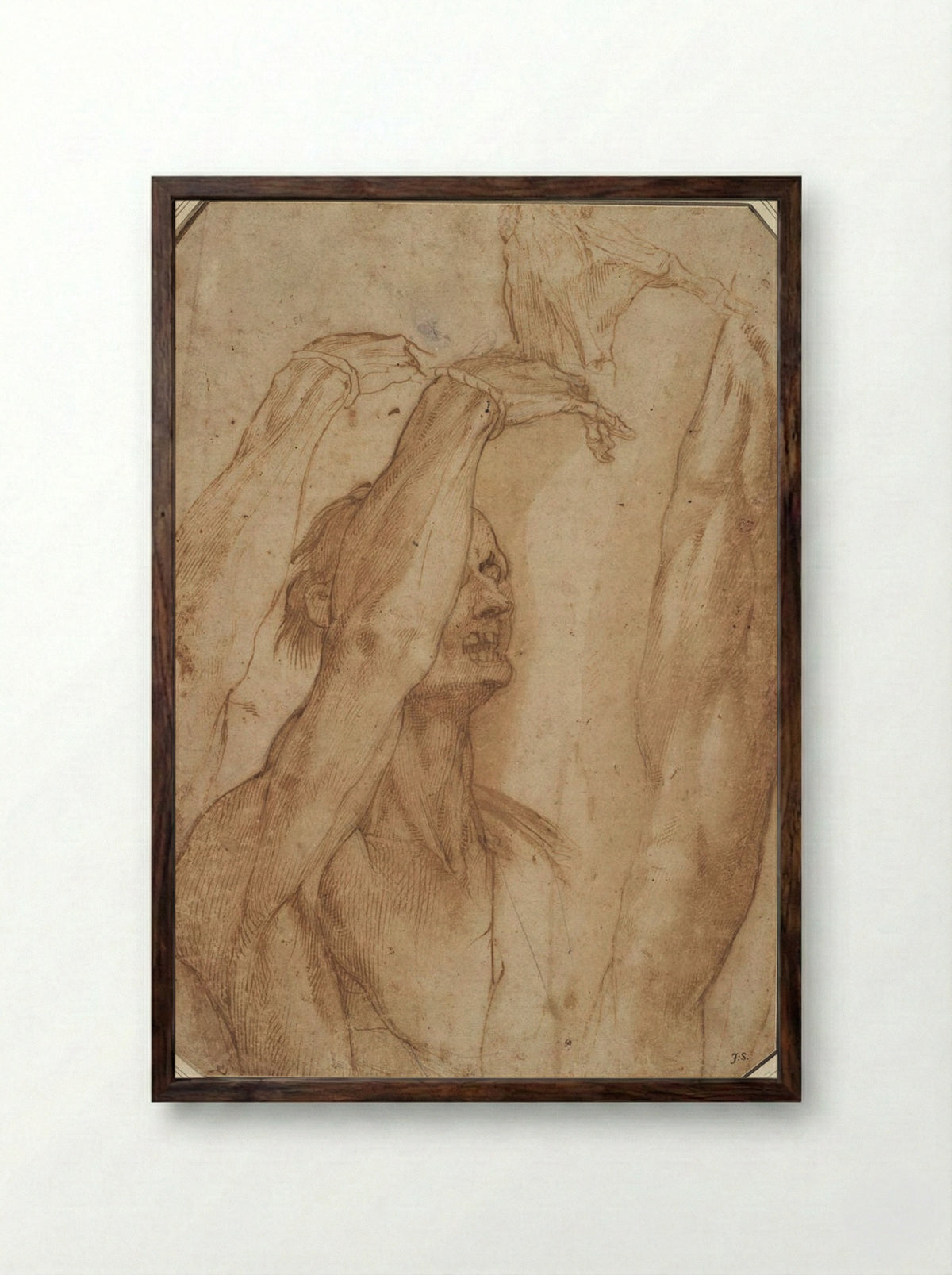 Studies from a Suspended Cadaver: Arm, Hand and Leg - Jacopo Ligozzi - Framed Print Dark Wood