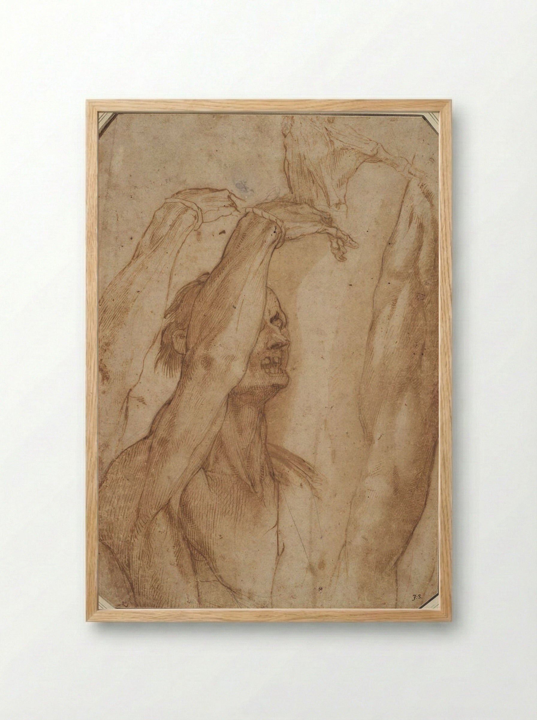 Studies from a Suspended Cadaver: Arm, Hand and Leg - Jacopo Ligozzi - Framed Print Wood