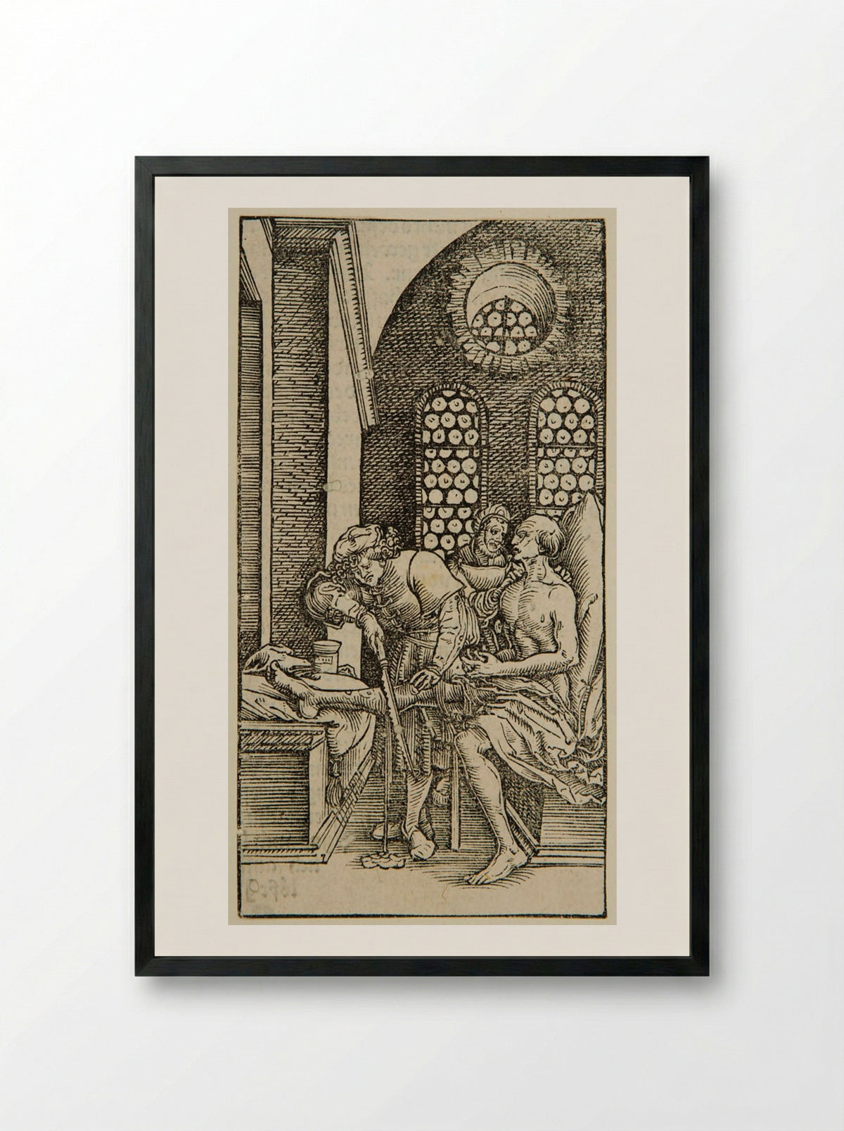 Surgeon Cutting off a Man's Leg - Hans Weiditz - Framed Print Black