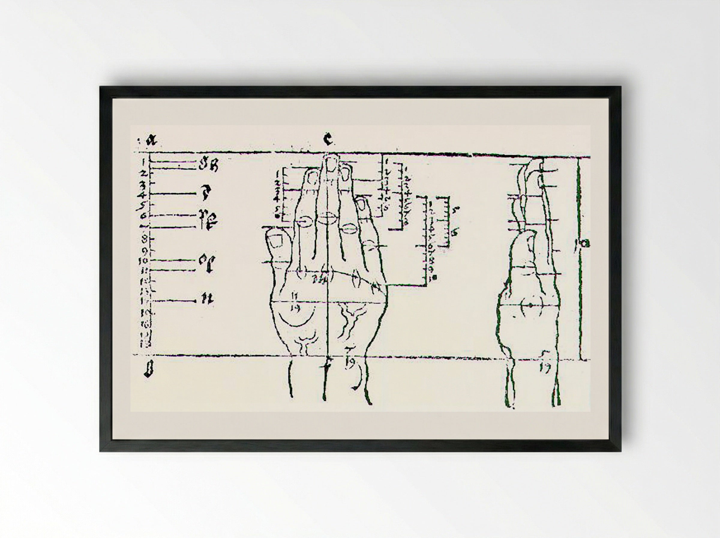 Untitled (Anatomical Study of a Hand) - Fine Art Print - Framed Print Black