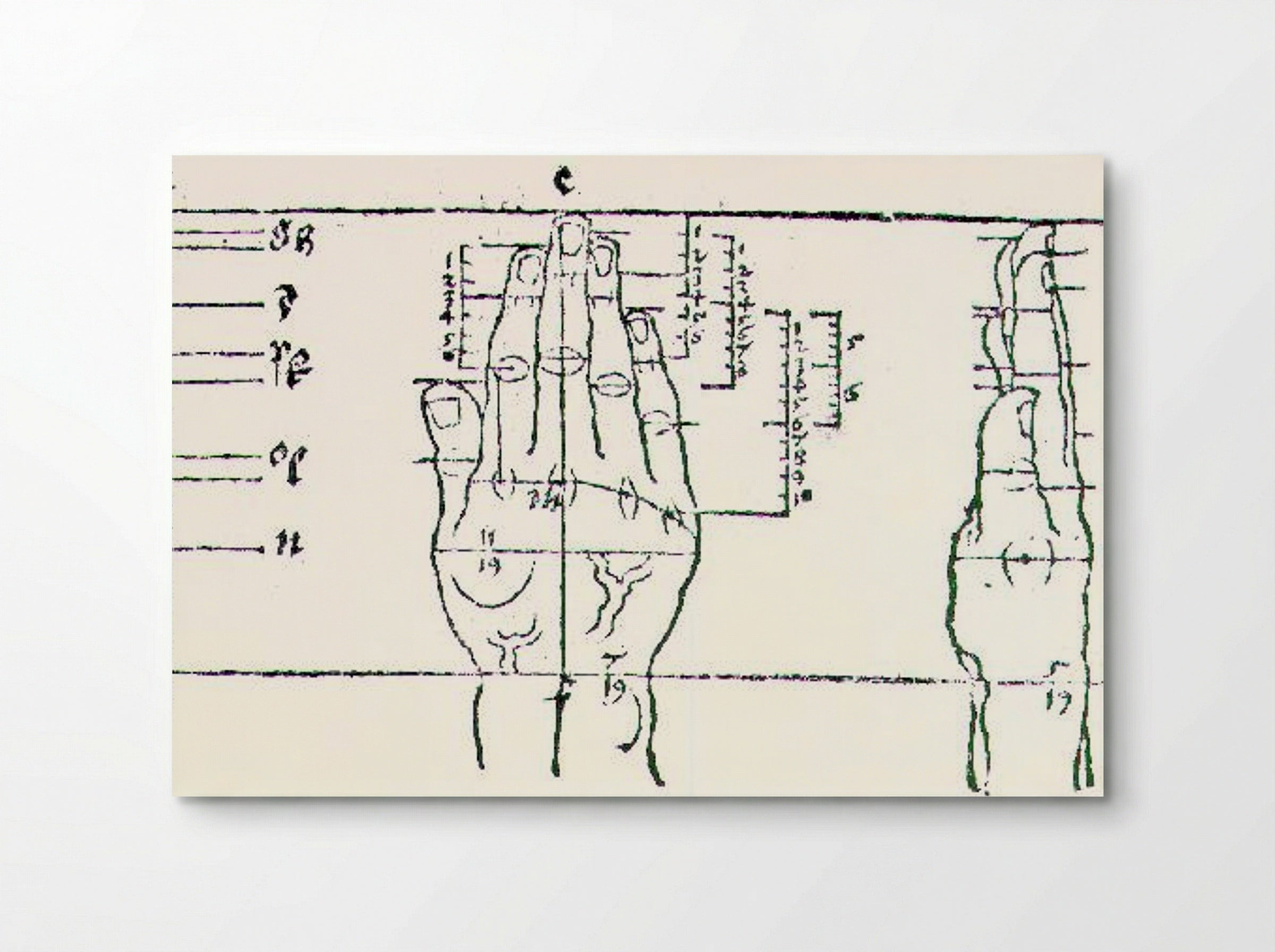 Untitled (Anatomical Study of a Hand) - Fine Art Print - Poster