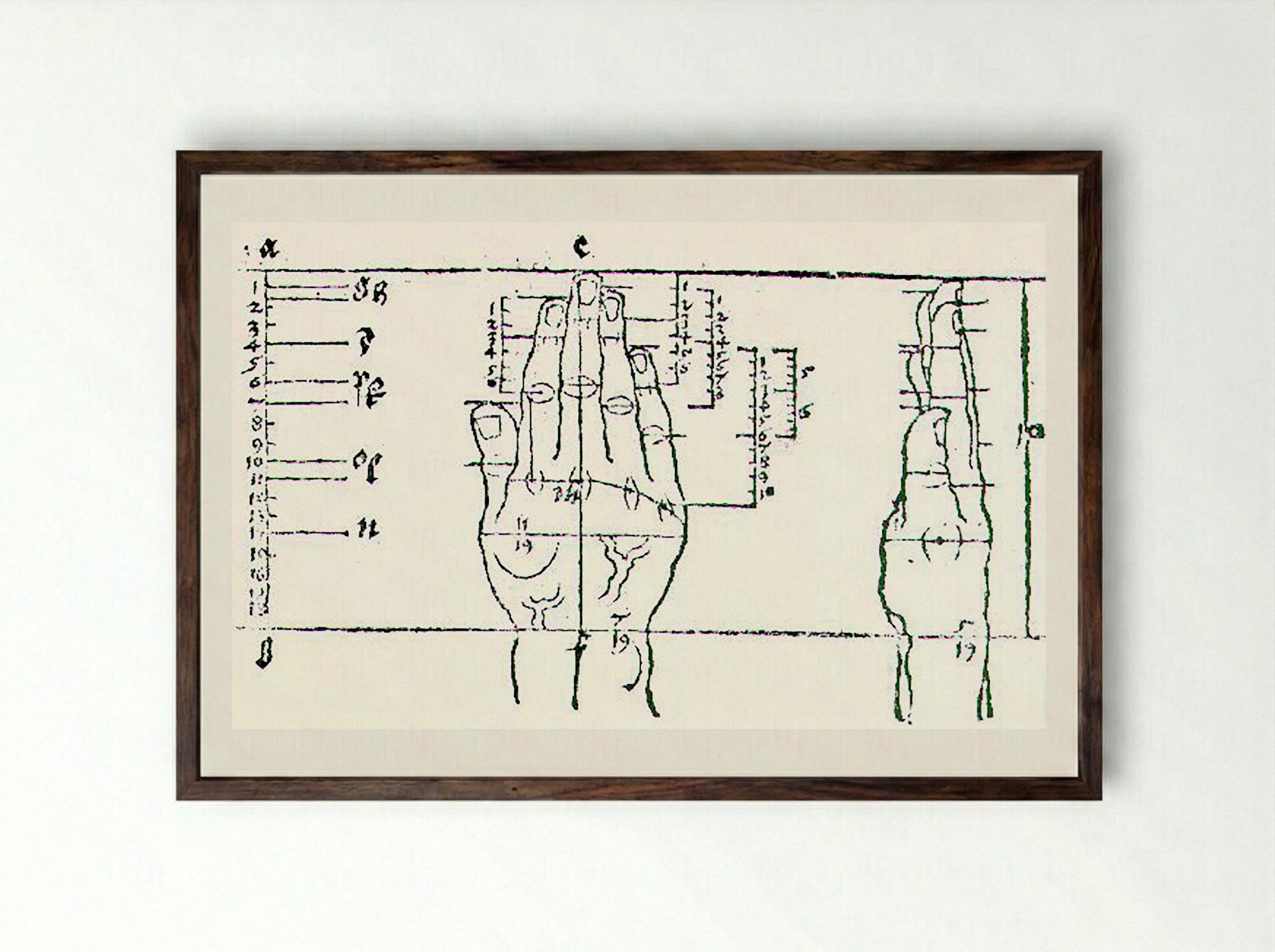 Untitled (Anatomical Study of a Hand) - Fine Art Print - Framed Print Dark Wood