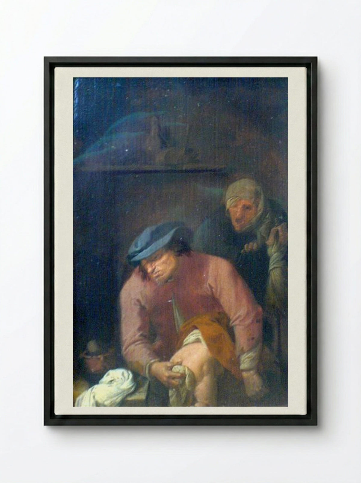 The Operation - Adriaen Brouwer - Framed Canvas Black