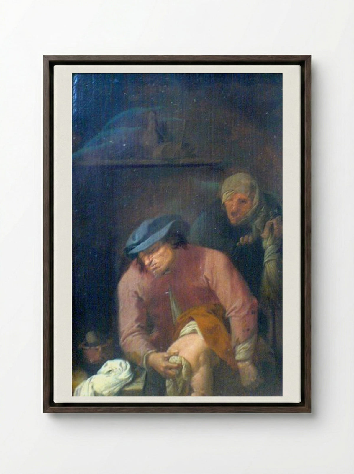 The Operation - Adriaen Brouwer - Framed Canvas Dark Wood